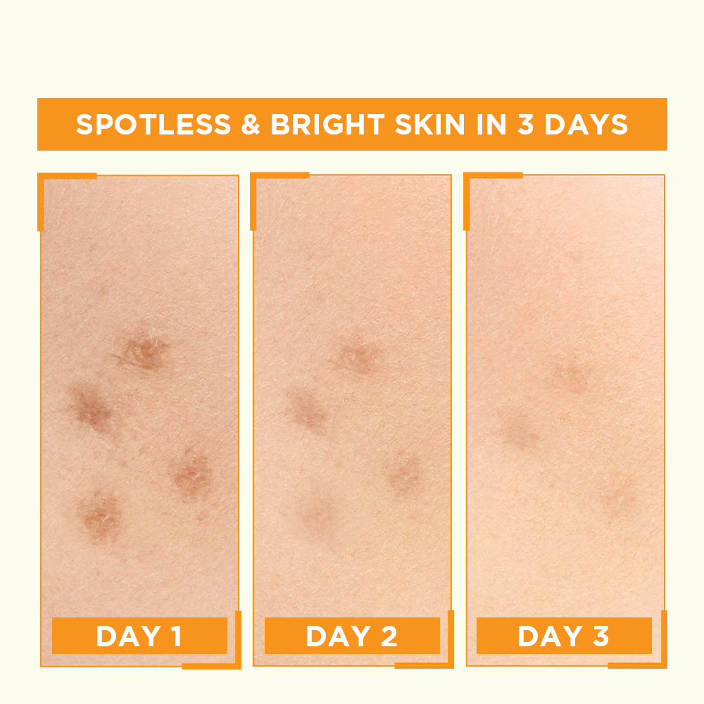 Garnier Bight Complete Vitamin C Booster Serum 30 ml - Contains Niacinamide
